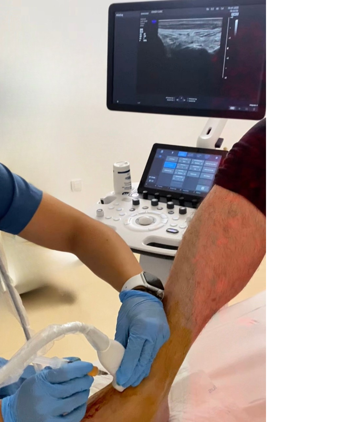 Pagina sobre nosotros. instalaciones y teecnología. ecografo